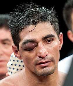 МАЙДАНА: «Щоб нокаутувати Моралеса, потрібна кувалда»