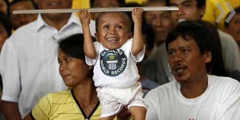 Житель Філіппін визнаний найменшою людиною в світі