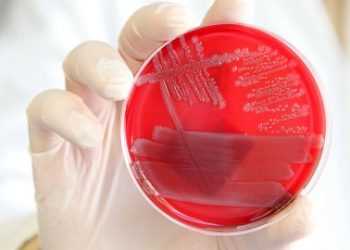 EHEC. У дитячому садку виявлено випадок захворювання бактерією EHEC