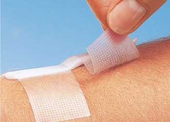 Винайдено ефективний пластир проти шрамів і рубців