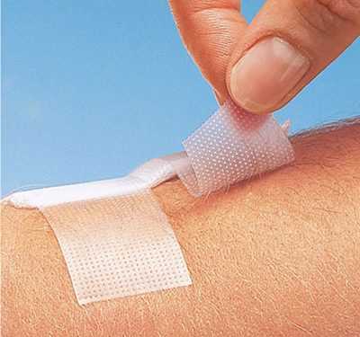 Винайдено ефективний пластир проти шрамів і рубців