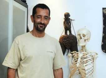 В Іспанії провели першу в світі пересадку ніг