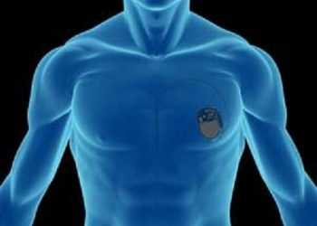 У Колумбії розроблений кардіостимулятор розміром з рисове зернятко