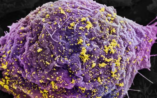 Створено вірус для знищення ВІЛ