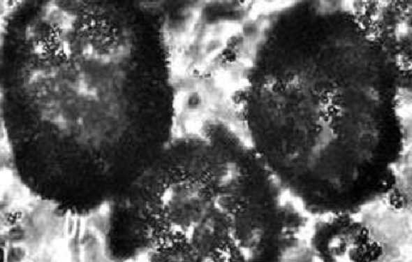 Знайдена найстаріша мікробна скам'янілість