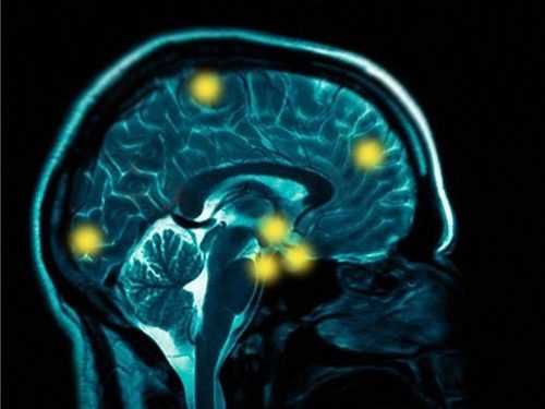 Вчені знайшли спосіб переглядати інформацію з мозку