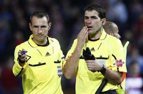 Арбітра поранили парасолькою