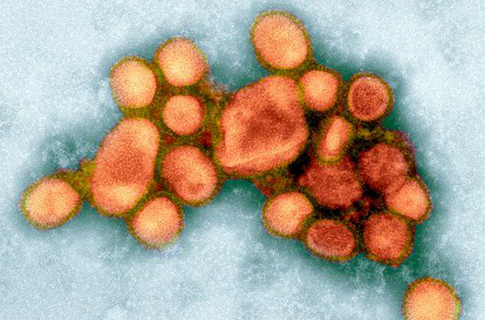 У Америці розробили нові ліки від СНІДу