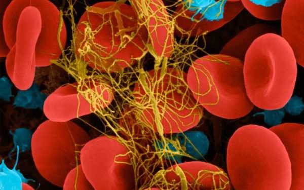 З тромбами будуть боротися за допомогою наночасток