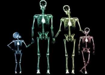 Українські вчені навчаються зварювати людські кістки