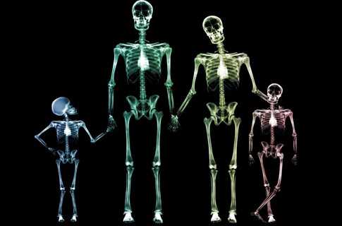 Українські вчені навчаються зварювати людські кістки