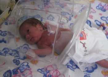 В Тернополе спасли малыша весом 530 граммов