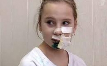 Собака искусала ребенка до неузнаваемости