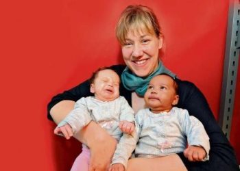 Близнюки з різним кольором шкіри