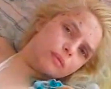 В дівчини досі видно слід на шиї від черевика