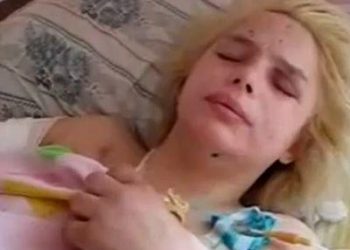 Оксана вже перенесла дві операції