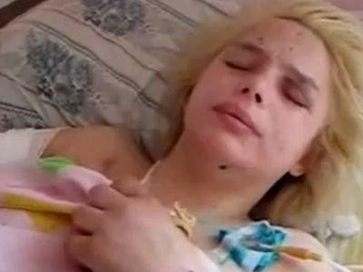 Оксана вже перенесла дві операції