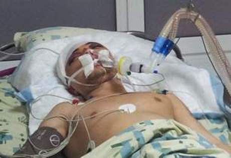 У Києві невідомі проломили пляшкою череп студенту-єврею