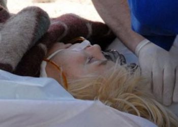 Оксана Макар була підключена до справного обладнання - медики