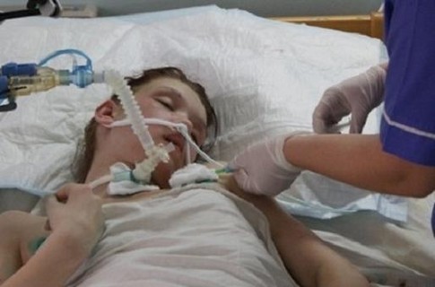 Жертву николаевского садиста будут лечить врачи из Германии