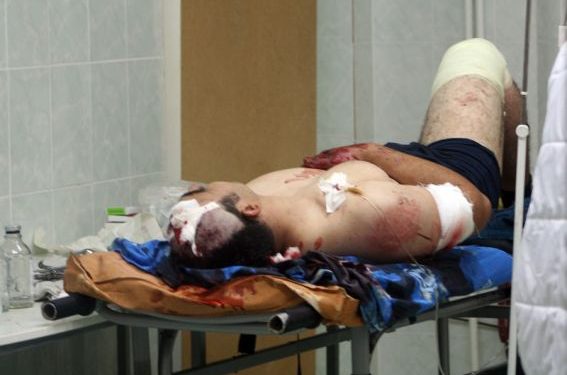 15 пострадавших при взрывах в Махачкале находятся в тяжёлом состоянии