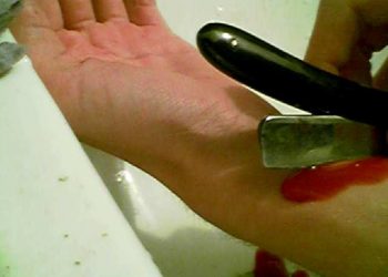 В Киеве юноша вскрыл вены и спрыгнул с «моста влюбленных»