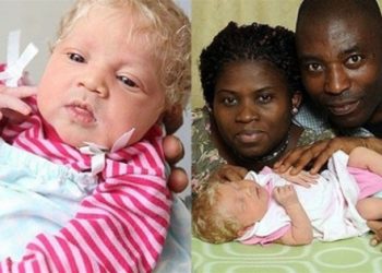 У Палермо в родині іммігрантів з Нігерії народилася абсолютно біла дитина
