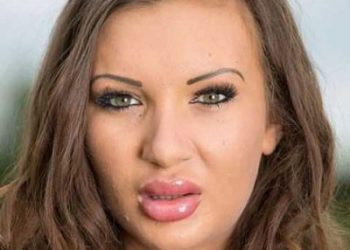 Жительница Великобритании увеличила себе губы за 14 тыс долларов