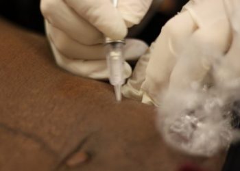 Дерматологи знают, как избавиться от растяжек