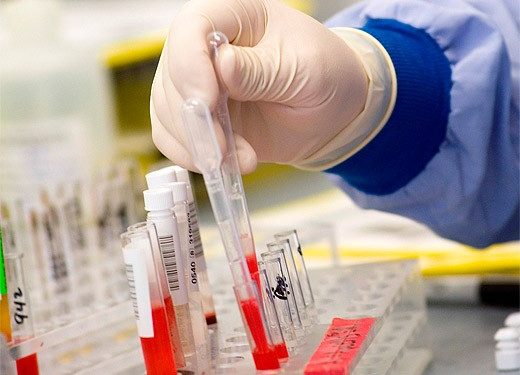 В области ранней диагностики раковых заболеваний сделано новое открытие