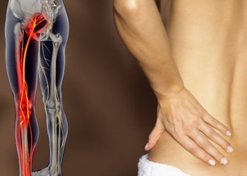 защемление седалищного нерва