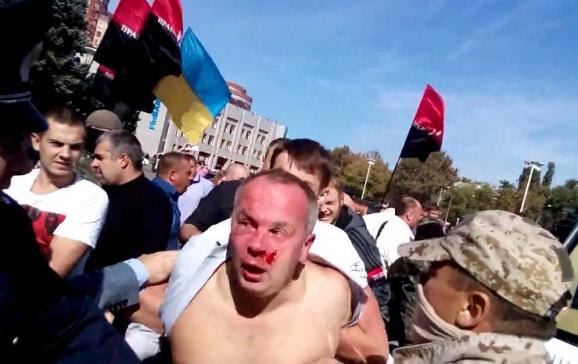 В Одессе избили депутата Нестора Шуфрича