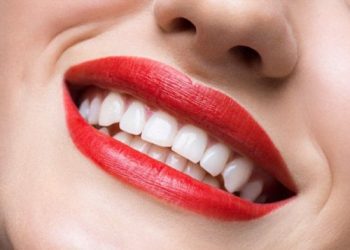 Специалисты сообщили, что значит желтизна зубов