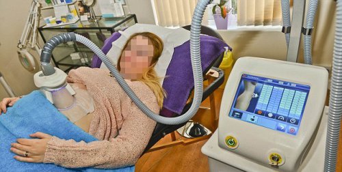 Ученые рассказали о заморозке лишнего жира