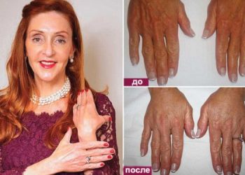 Эксперты рассказали, как можно омолодить постаревшие руки