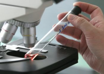 В Украине есть первые подозрения на Эболу