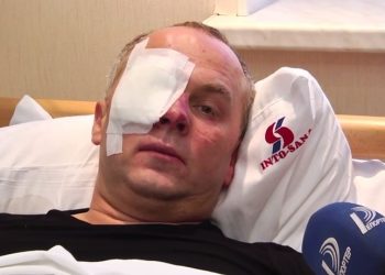 Шуфрич прокомментировал свое избиение в Одессе