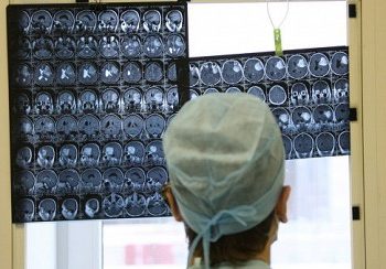 В США из Техасского университета пропали 100 банок с человеческими мозгами
