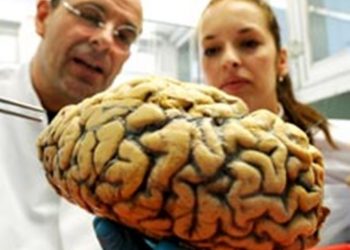 Специалисты нашли новые различия в мозге у мужчин и женщин