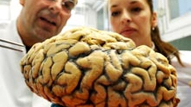 Специалисты нашли новые различия в мозге у мужчин и женщин