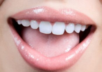 Какие причины стоматита и как его лечить
