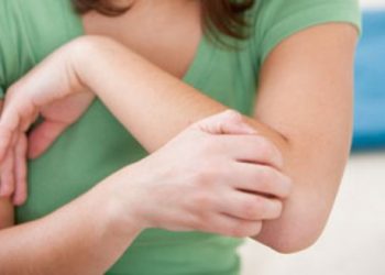 Эксперты рассказали о народных способах унять кожный зуд
