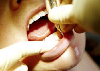 Что укрепляет здоровье сердечно-сосудистой системы