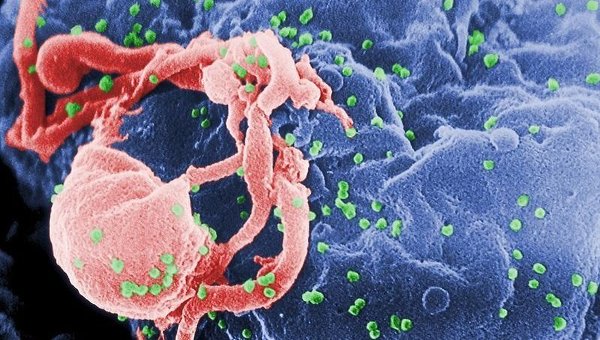Вирусологам удалось подавить ВИЧ в организме человека
