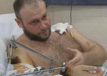 Состояние Дмитрия Яроша очень тяжелое
