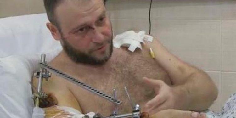 Состояние Дмитрия Яроша очень тяжелое