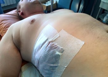 Раненого Булатова увезли в Киев