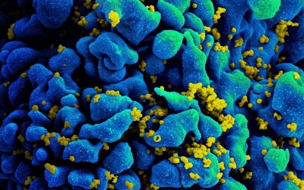 Зафиксировали первый случай долгосрочной ремиссии ВИЧ без лечения