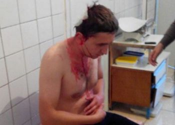 В Олевске избили сотрудника СМИ, боровшегося против нелегального промысла янтаря