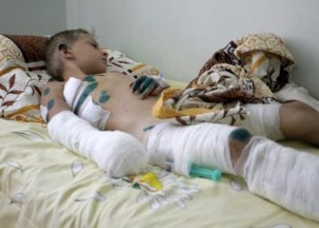 Врачи борются за жизни детей, раненых под Мариуполем